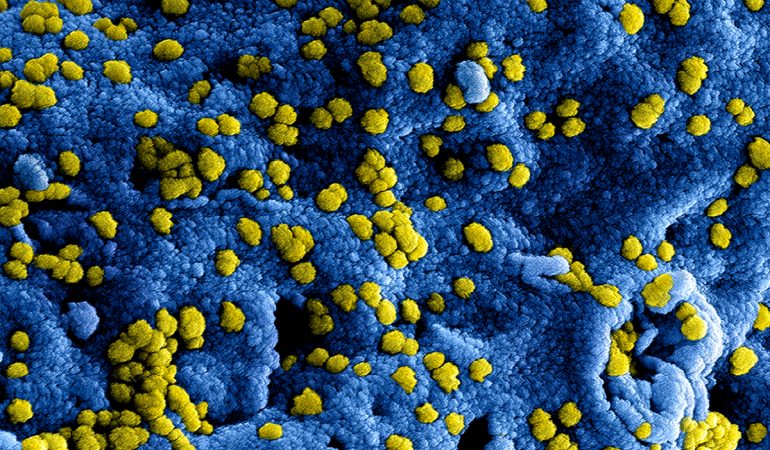 Bezoekers: volg RIVM-adviezen coronavirus